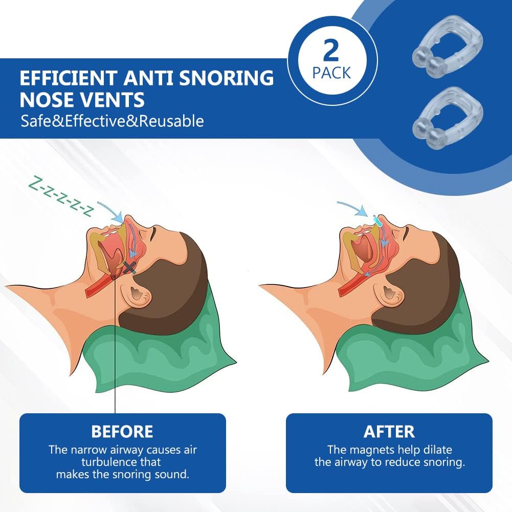 Elite™ Anti-Snore Nasal Clips – The Tiny Device Saving Marriages ❤️