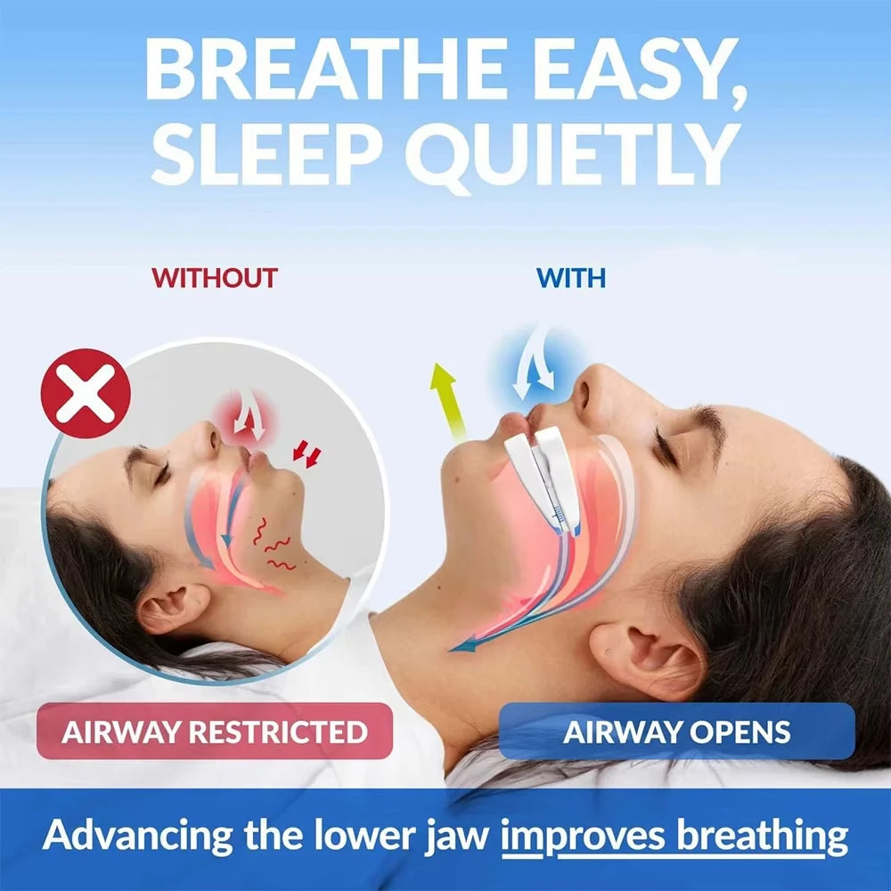Elite™ Anti-Snoring Mouth Guard