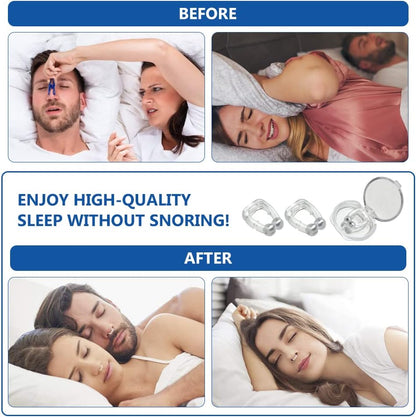 Elite™ Anti-Snore Nasal Clips – The Tiny Device Saving Marriages ❤️